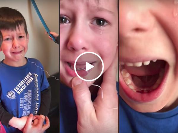 Little brother helps out with tooth pulling (Video)