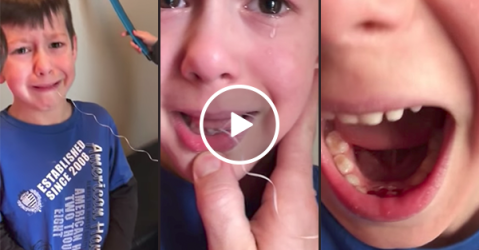 Little brother helps out with tooth pulling (Video)