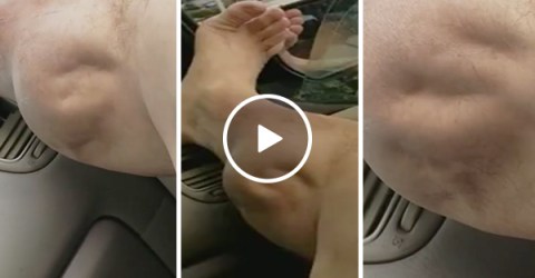 Man has incredible pulsating cramp in his calf (Video)