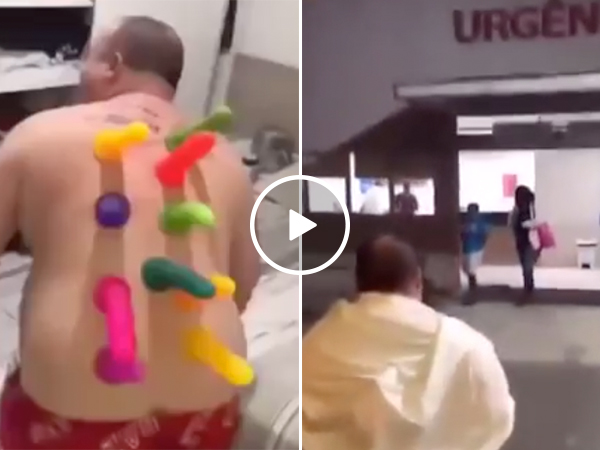 Warning: Glueing 10 dildos to your friend's back MIGHT end up in an ER trip (Video)